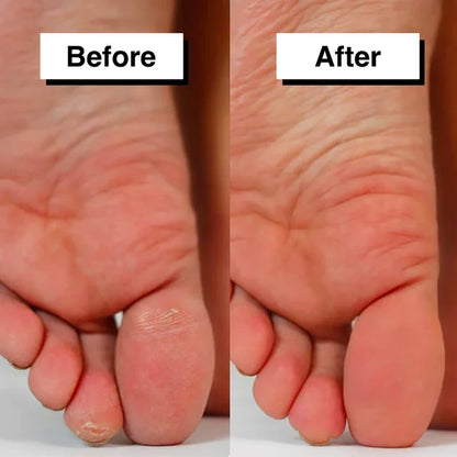 Pedicuure - Automatic Callus Remover